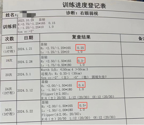 视力逆袭之战！ 高三学生弱视险影响专业报考