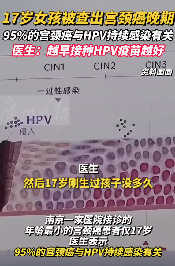 17岁女孩查出宫颈癌已是晚期 医生：刚生过孩子没多久